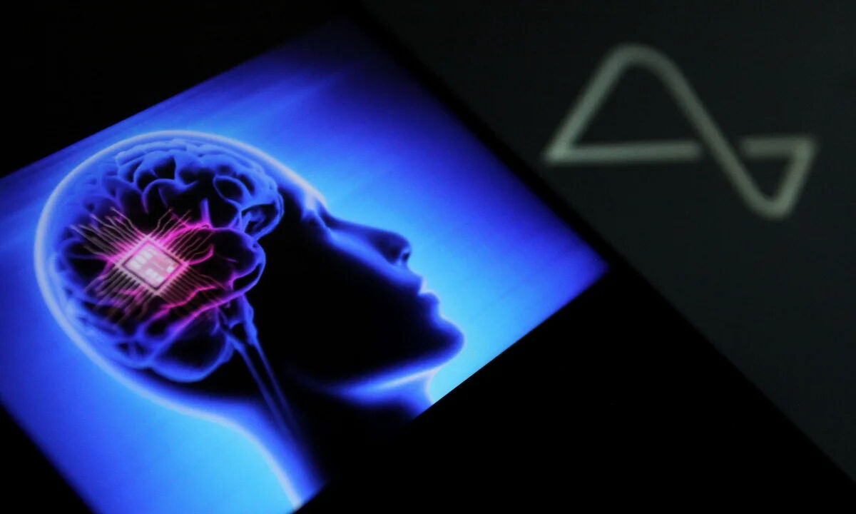 Neuralink insan beynine bağlandı: Üçüncü hasta tarihe geçti! Neuralink insan beynine bağlandı: Üçüncü hasta tarihe geçti! - 1. Resim