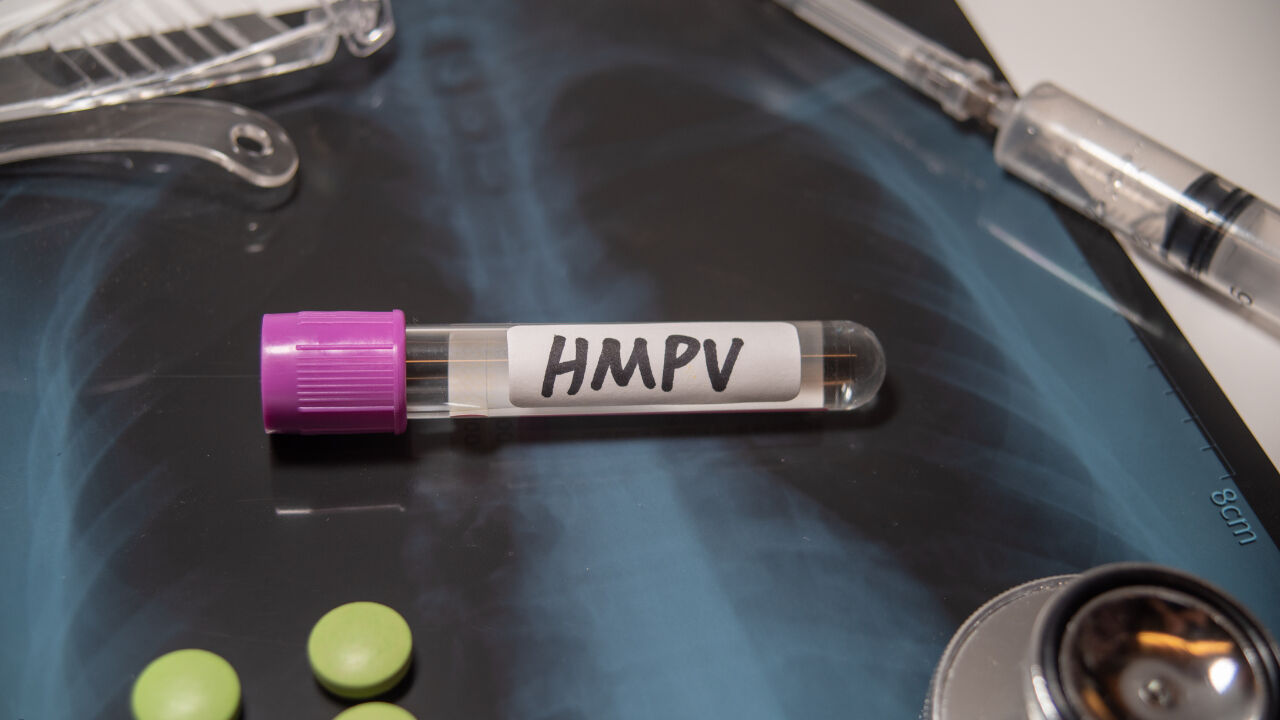 HMPV virüsü belirtileri nedir, ölümcül müdür? Türkiye henüz görülmediği belirtildi! HMPV virüsü belirtileri nedir, ölümcül müdür? Türkiye henüz görülmediği belirtildi! - 3. Resim