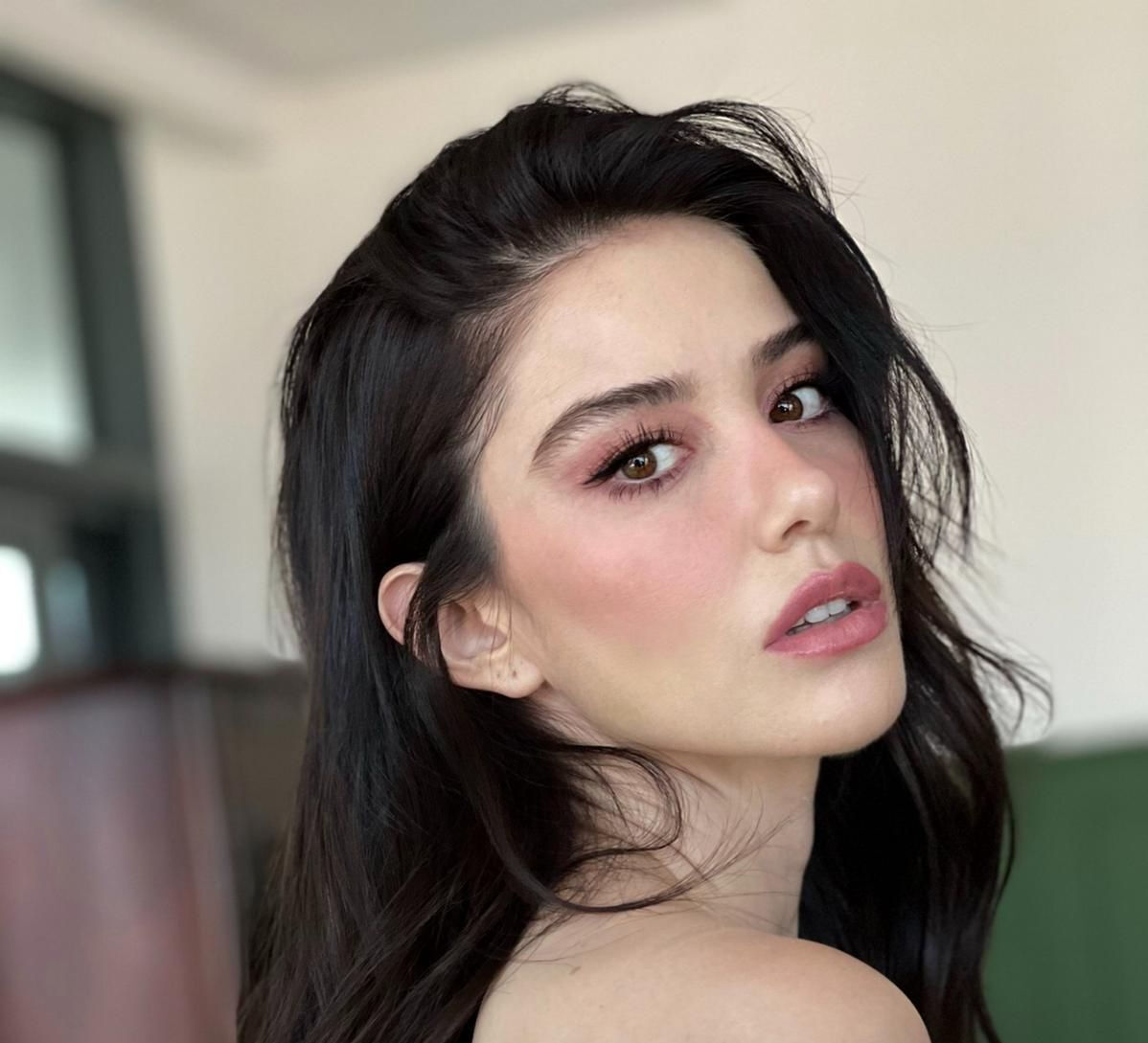 Ünlü oyuncu Özge Gürel'den korkutan haber! Yüzü yandı - 2. Resim