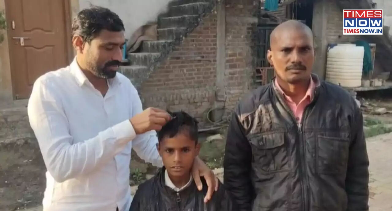 Hindistan’da gizemli salgın: 150 kişi bir haftada kel kaldı - 1. Resim