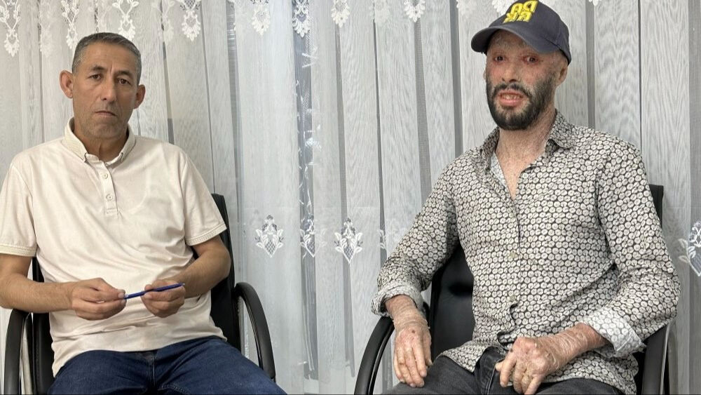 Sadece iğneleri 42 bin lira! Derisi pul pul dökülen Hakkarili 'iktiyozis' hastası tedaviye cevap verdi Sadece iğneleri 42 bin lira! Derisi pul pul dökülen Hakkarili 'iktiyozis' hastası tedaviye cevap verdi - 1. Resim