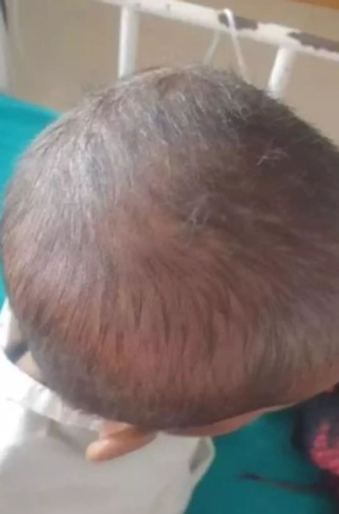 4 yaşındaki kızın midesinden çıktı! Doktorlar bile inanamadı: "Kuyruğu var" 4 yaşındaki kızın midesinden çıktı! Doktorlar bile inanamadı: "Kuyruğu var" - 2. Resim