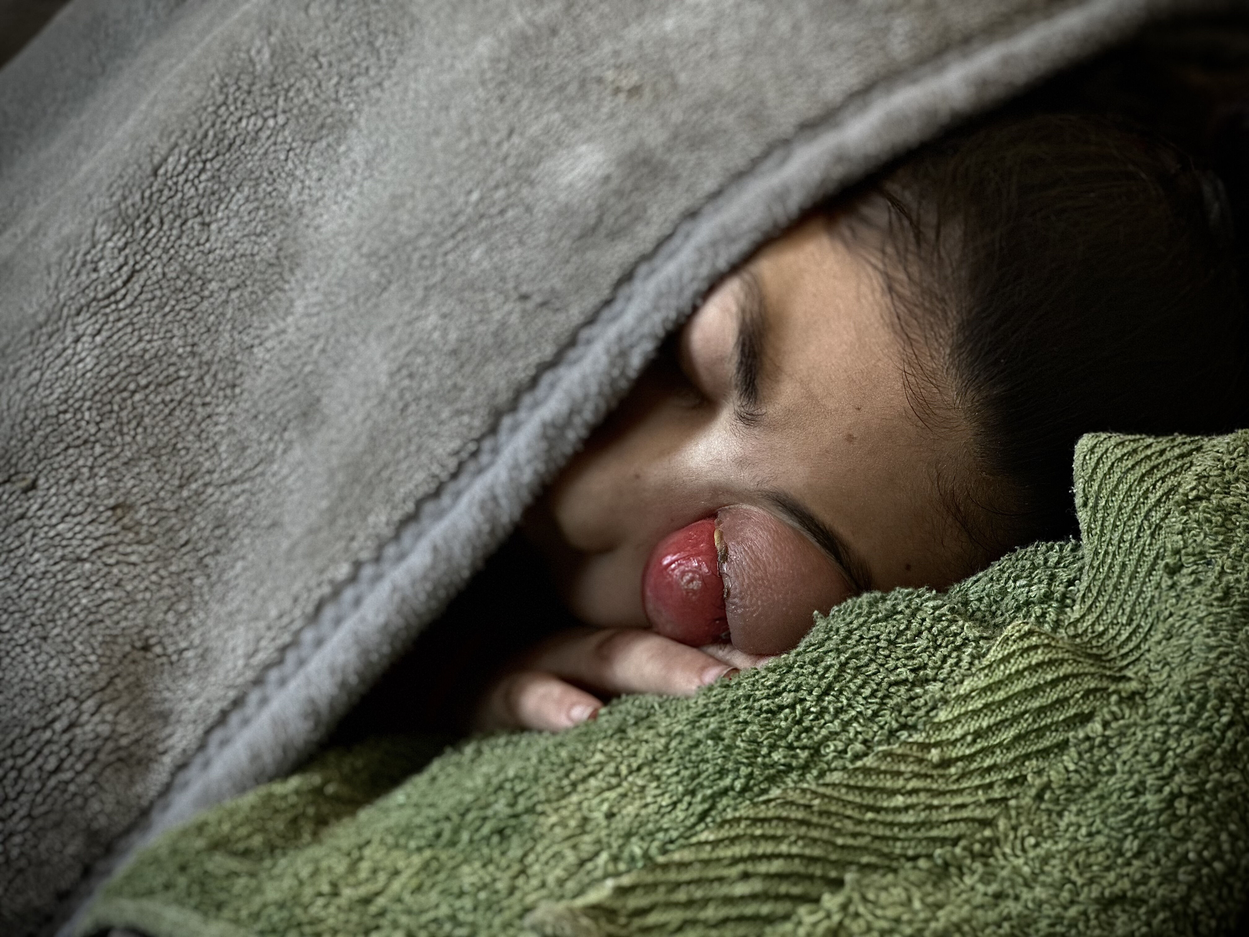 Masumiyet katledilmeye devam ediyor... Gazzeli Hanaa'nın acı çığlığını duyun! Masumiyet katledilmeye devam ediyor... Gazzeli Hanaa'nın acı çığlığını duyun! - 4. Resim