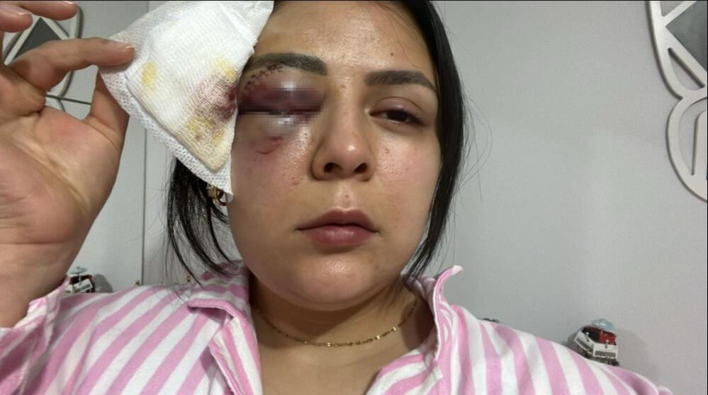 İşe giden genç kız hiç tanımadığı bir adamın saldırısına uğradı! İşe giden genç kız hiç tanımadığı bir adamın saldırısına uğradı! Onu bunu yapan serbest kaldı - 1. Resim