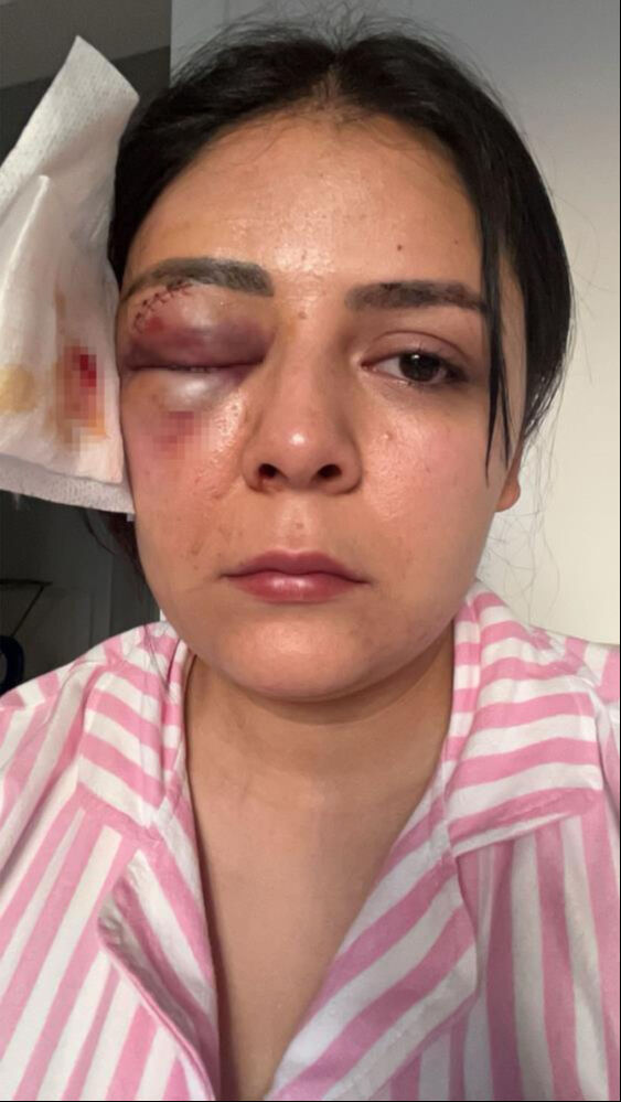 İşe giden genç kız hiç tanımadığı bir adamın saldırısına uğradı! İşe giden genç kız hiç tanımadığı bir adamın saldırısına uğradı! Onu bunu yapan serbest kaldı - 2. Resim