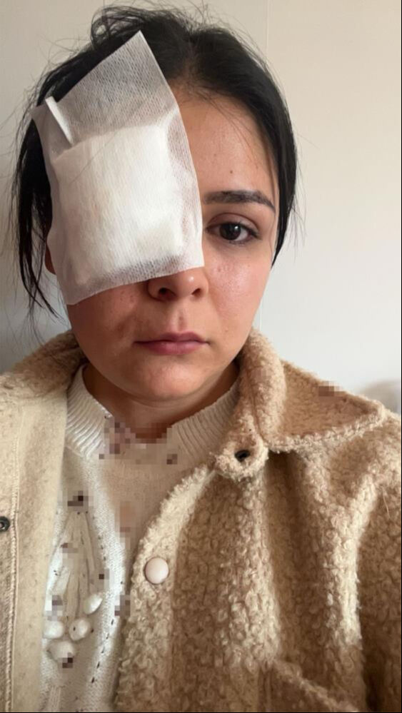 İşe giden genç kız hiç tanımadığı bir adamın saldırısına uğradı! İşe giden genç kız hiç tanımadığı bir adamın saldırısına uğradı! Onu bunu yapan serbest kaldı - 4. Resim