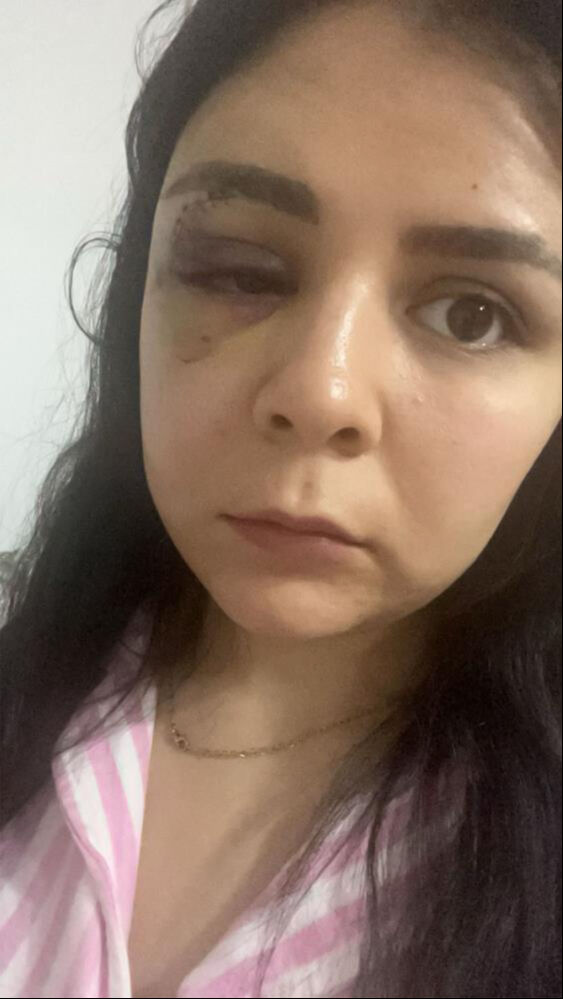 İşe giden genç kız hiç tanımadığı bir adamın saldırısına uğradı! İşe giden genç kız hiç tanımadığı bir adamın saldırısına uğradı! Onu bunu yapan serbest kaldı - 3. Resim