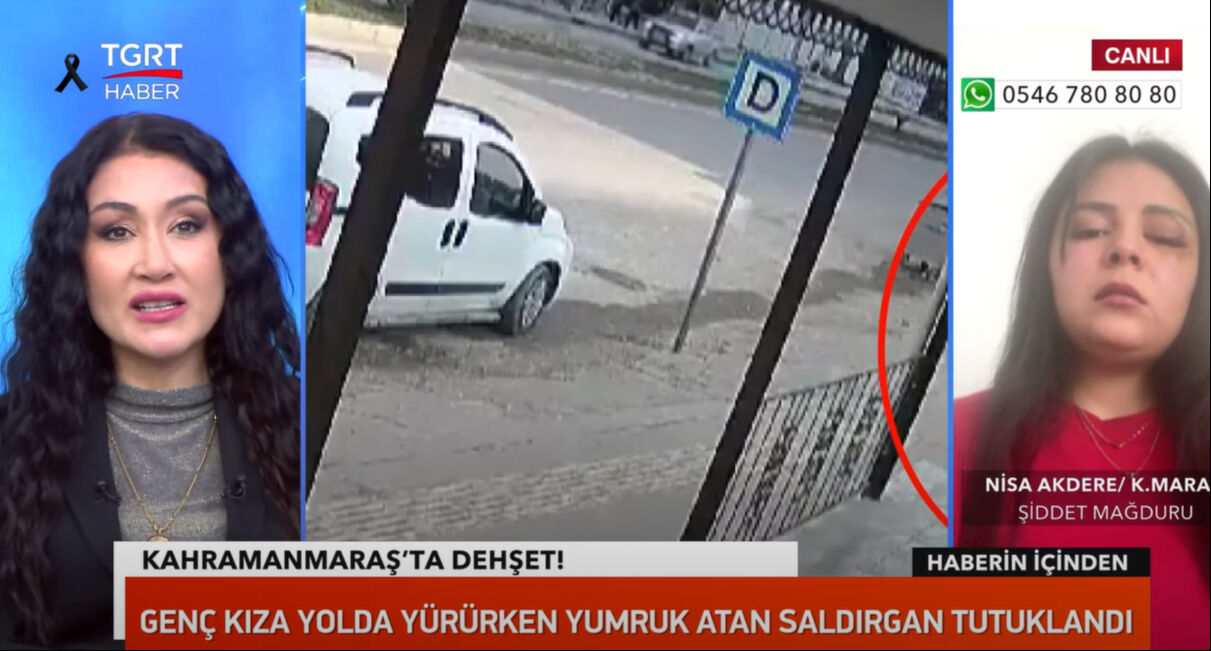 Genç kıza yumruklu saldırı! O korkunç anları TGRT Haber'e tek tek anlattı!  Genç kıza yumruklu saldırı! O korkunç anları TGRT Haber'e tek tek anlattı!