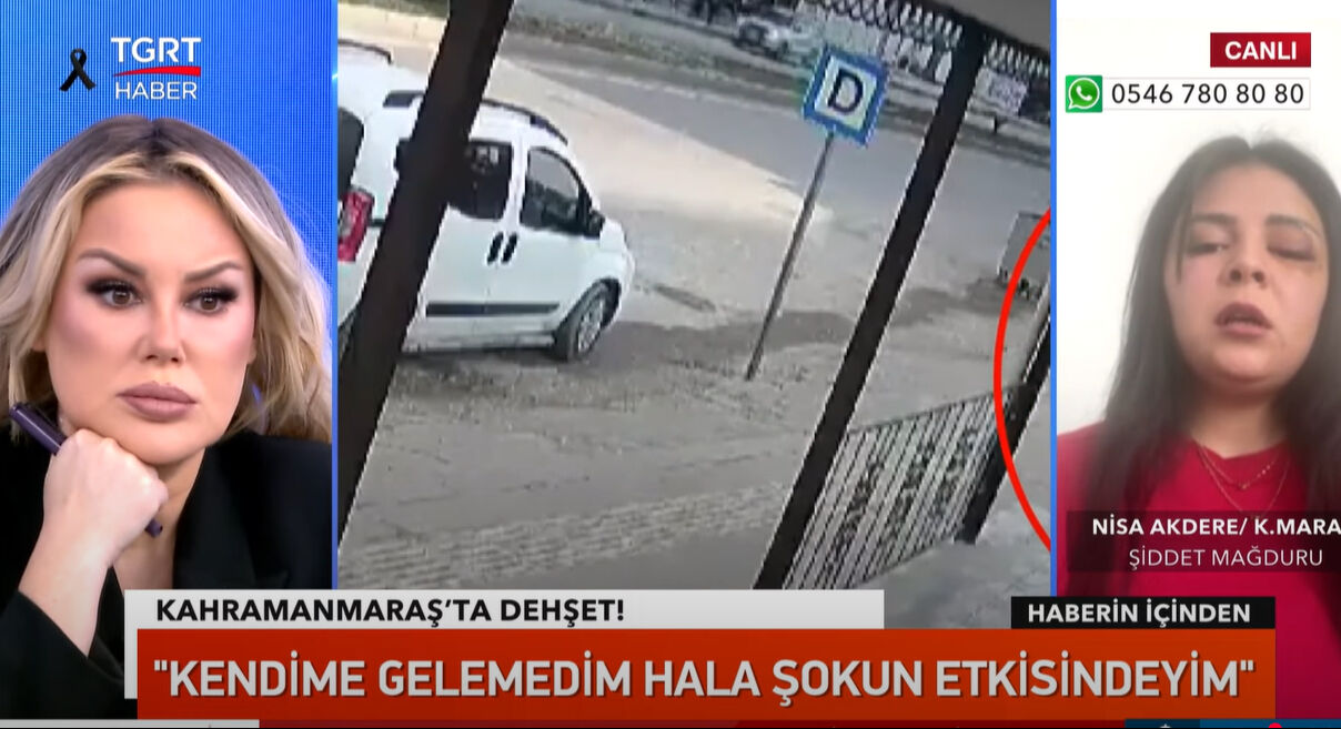 Genç kıza yumruklu saldırı! O korkunç anları TGRT Haber'e tek tek anlattı!  Genç kıza yumruklu saldırı! O korkunç anları TGRT Haber'e tek tek anlattı!