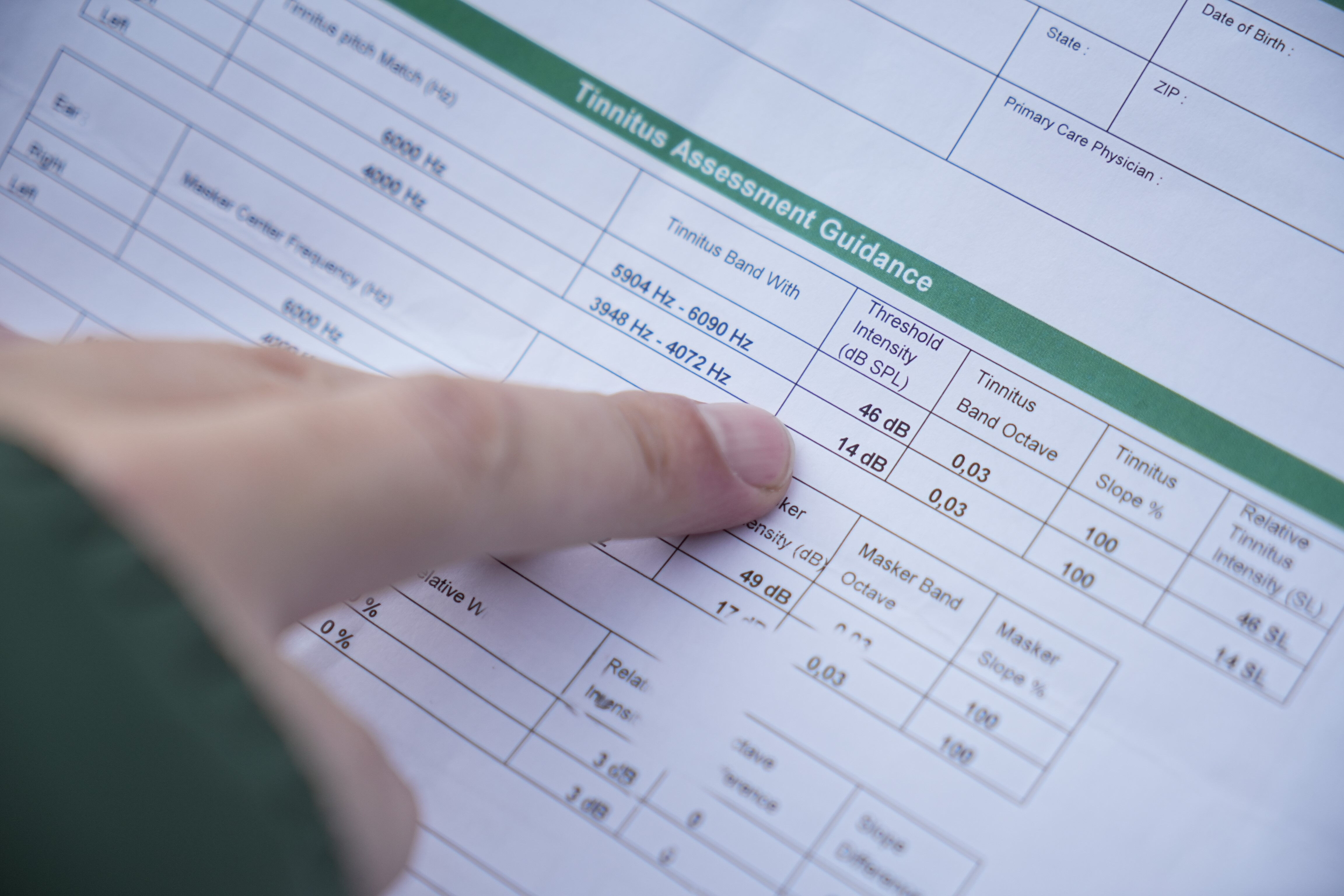 Saç ektirmek istedi, hayatı altüst oldu! "Tedavisi yok, bununla yaşamayı öğren" dediler... Saç ektirmek istedi, hayatı altüst oldu! "Tedavisi yok, bununla yaşamayı öğren" dediler... - 1. Resim