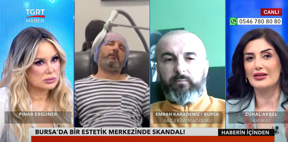 Kafasına saç ektirmek istemişti! Başına saçtan başka her şey geldi! O zorlu süreci TGRT Haber'e anlattı - 3. Resim