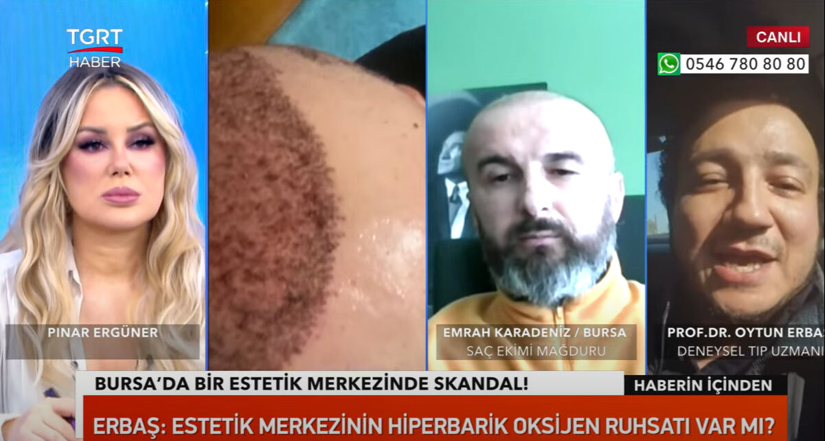 Kafasına saç ektirmek istemişti! Başına saçtan başka her şey geldi! O zorlu süreci TGRT Haber'e anlattı - 6. Resim