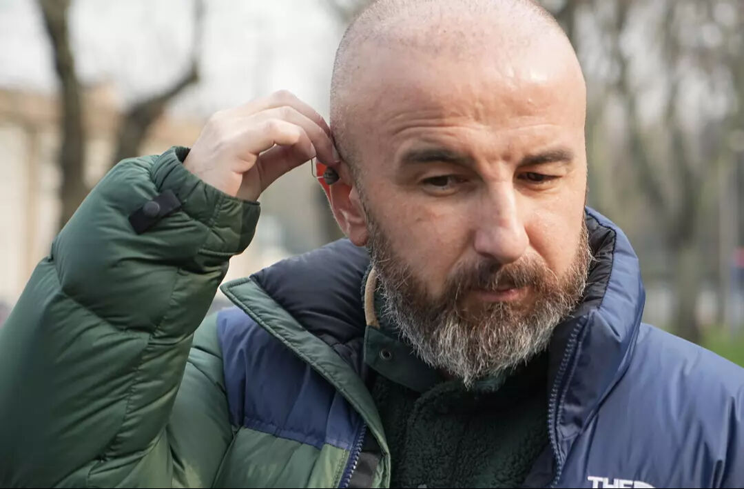 Kafasına saç ektirmek istemişti! Başına saçtan başka her şey geldi! O zorlu süreci TGRT Haber'e anlattı - 1. Resim