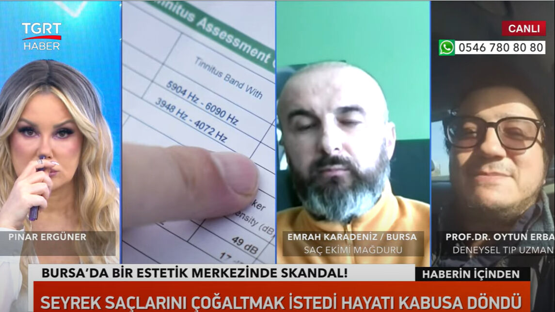 Kafasına saç ektirmek istemişti! Başına saçtan başka her şey geldi! O zorlu süreci TGRT Haber'e anlattı - 5. Resim