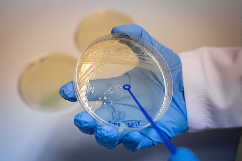 Müsilaja virüslü çözüm! Zararlı mikroorganizmaları azaltan yöntem bulundu - 2. Resim