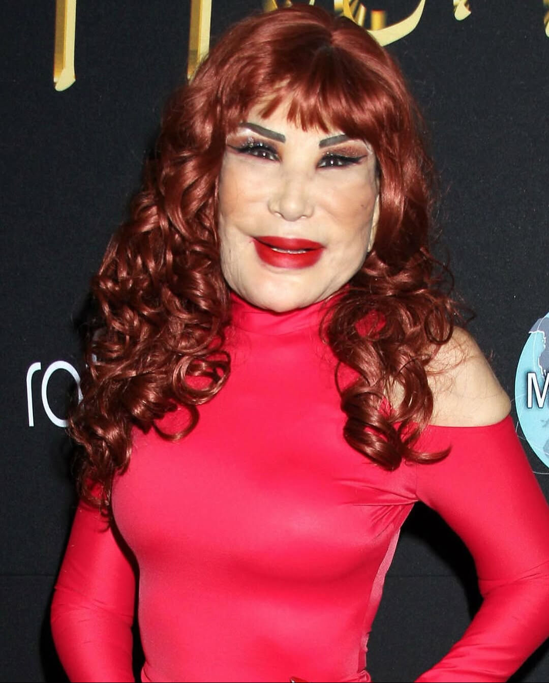 Bir dönemin efsanesiydi... Ünlü oyuncu Lyn May son haliyle korkuttu! Yüzüne yemek yağı enjekte ettirdiği ortaya çıktı Bir dönemin efsanesiydi... Ünlü oyuncu Lyn May son haliyle korkuttu! Yüzüne yemek yağı enjekte ettirdiği ortaya çıktı - 3. Resim