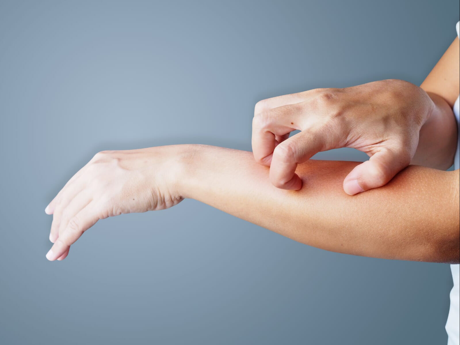 Hastaların üçte birinde görülüyor! Cilt kuruluğu deyip geçmeyin, böbrek hastalığının habercisi olabilir - 1. Resim