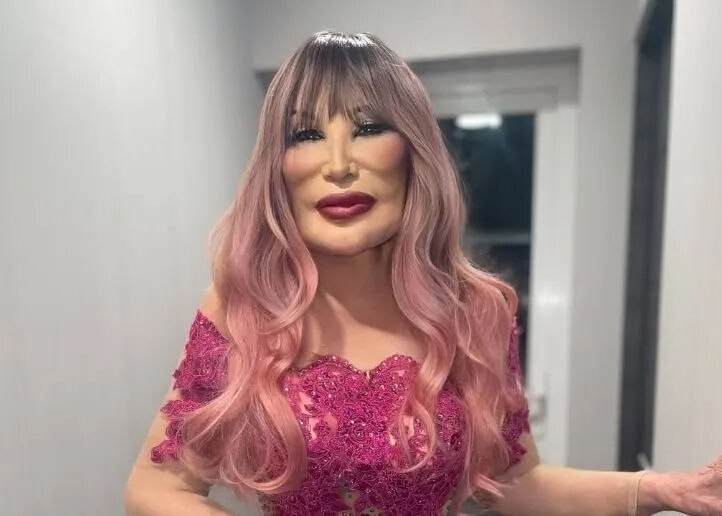 Bir dönemin efsanesiydi... Ünlü oyuncu Lyn May son haliyle korkuttu! Yüzüne yemek yağı enjekte ettirdiği ortaya çıktı Ünlü oyuncunun son hali korkuttu! Yüzüne yemeklik yağ enjekte ettirdi - 1. Resim