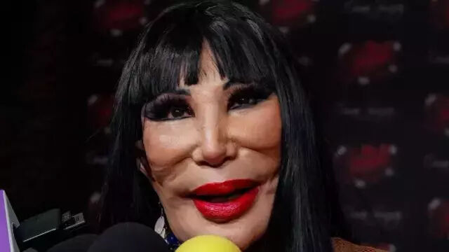 Bir dönemin efsanesiydi... Ünlü oyuncu Lyn May son haliyle korkuttu! Yüzüne yemek yağı enjekte ettirdiği ortaya çıktı Ünlü oyuncunun son hali korkuttu! Yüzüne yemeklik yağ enjekte ettirdi - 2. Resim