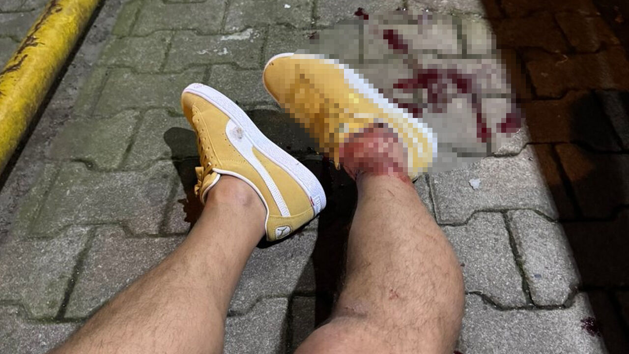 Serhat Akın'a silahlı saldırıda ilk duruşma! Ara kararda tahliyeler var Serhat Akın'a silahlı saldırıda ilk duruşma! Ara kararda tahliyeler var - 1. Resim