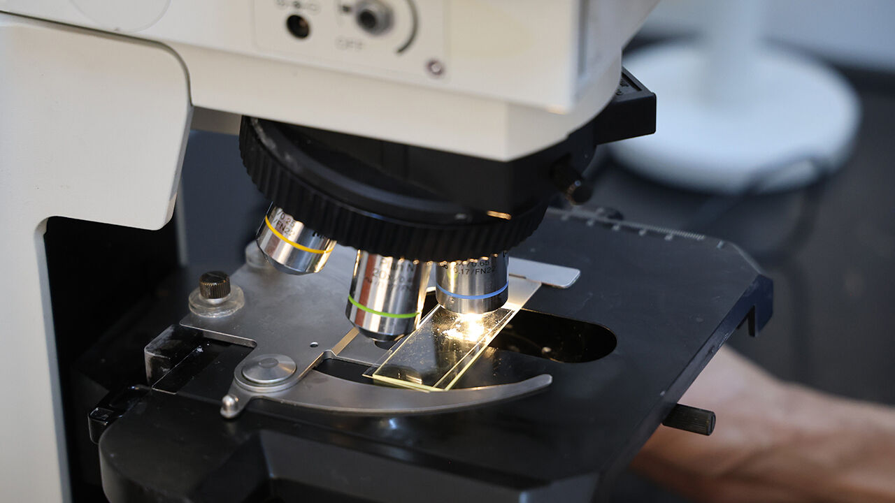 Temas eden herkes tedavi olmalı! Vaka sayısı her geçen gün artıyor, çok kolay bulaşıyor... İşte en temel belirtisi Temas eden herkes tedavi olmalı! Vaka sayısı her geçen gün artıyor, çok kolay bulaşıyor... İşte en temel belirtisi - 1. Resim