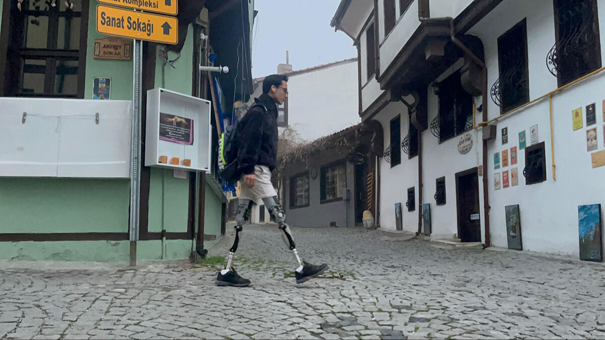 Azmiyle sporcuları hayran bıraktı! Protez bacaklarıyla 9 yıldır gittiği havuzda şampiyonluğa kulaç atıyor Azmiyle sporcuları hayran bıraktı! Protez bacaklarıyla 9 yıldır gittiği havuzda şampiyonluğa kulaç atıyor - 2. Resim