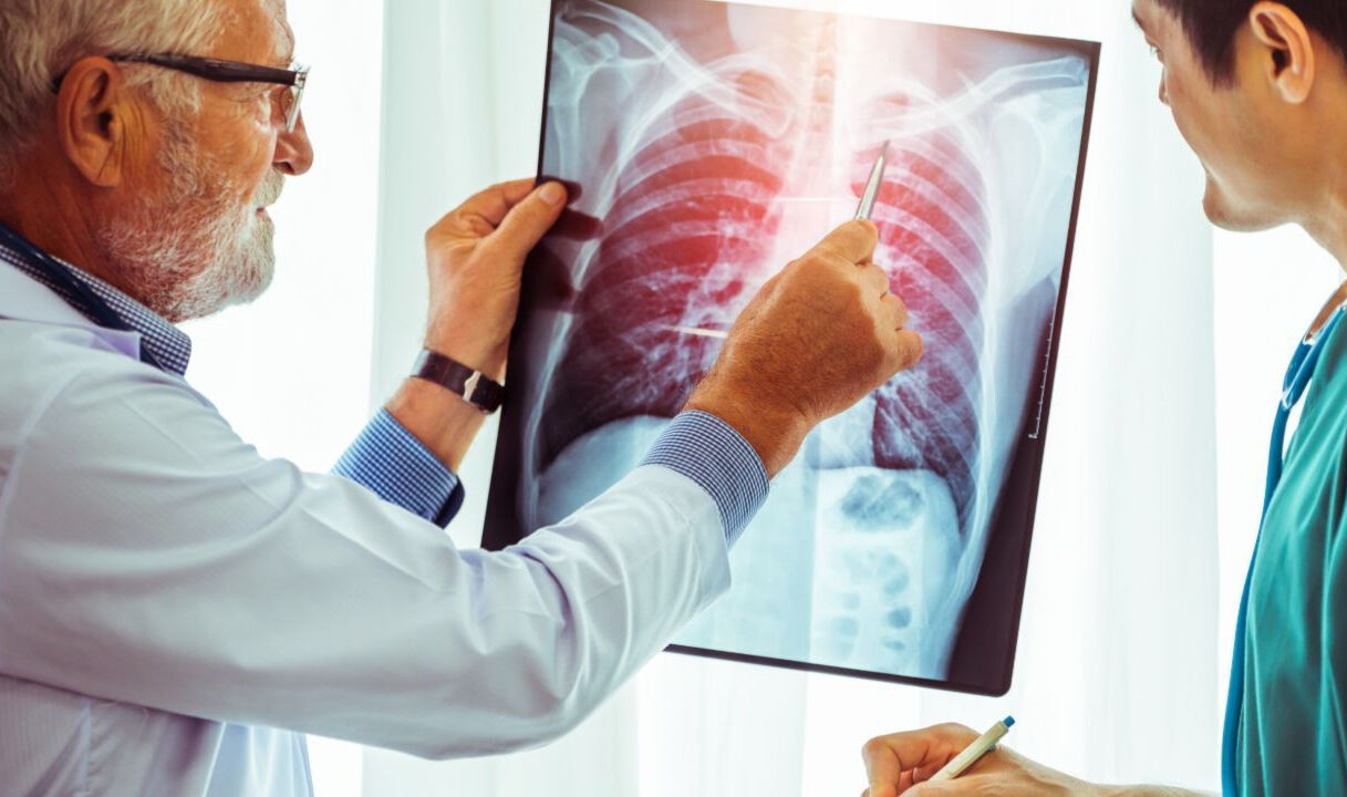 DSÖ'den çarpıcı kanser açıklaması! Kadınlarda kanser yükselişte... Sigara içmeyenler arasında akciğer kanseri artıyor - 1. Resim