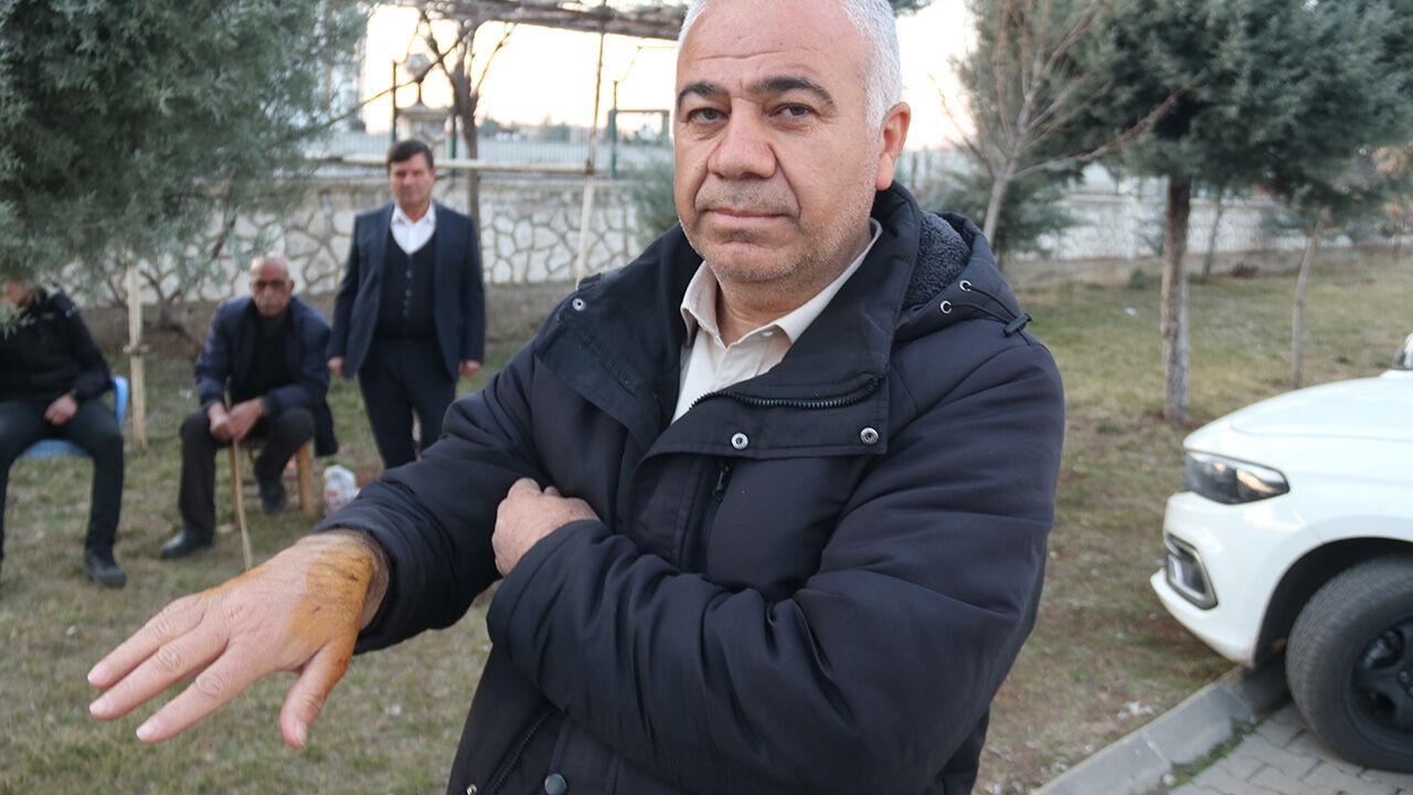 Sitede başıboş köpek dehşeti! Önce çocuğa, sonra 2 kişiye daha saldırdı - 2. Resim