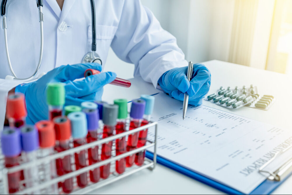 Kan tahlilleri: Bilmeniz gereken her şey! - 3. Resim