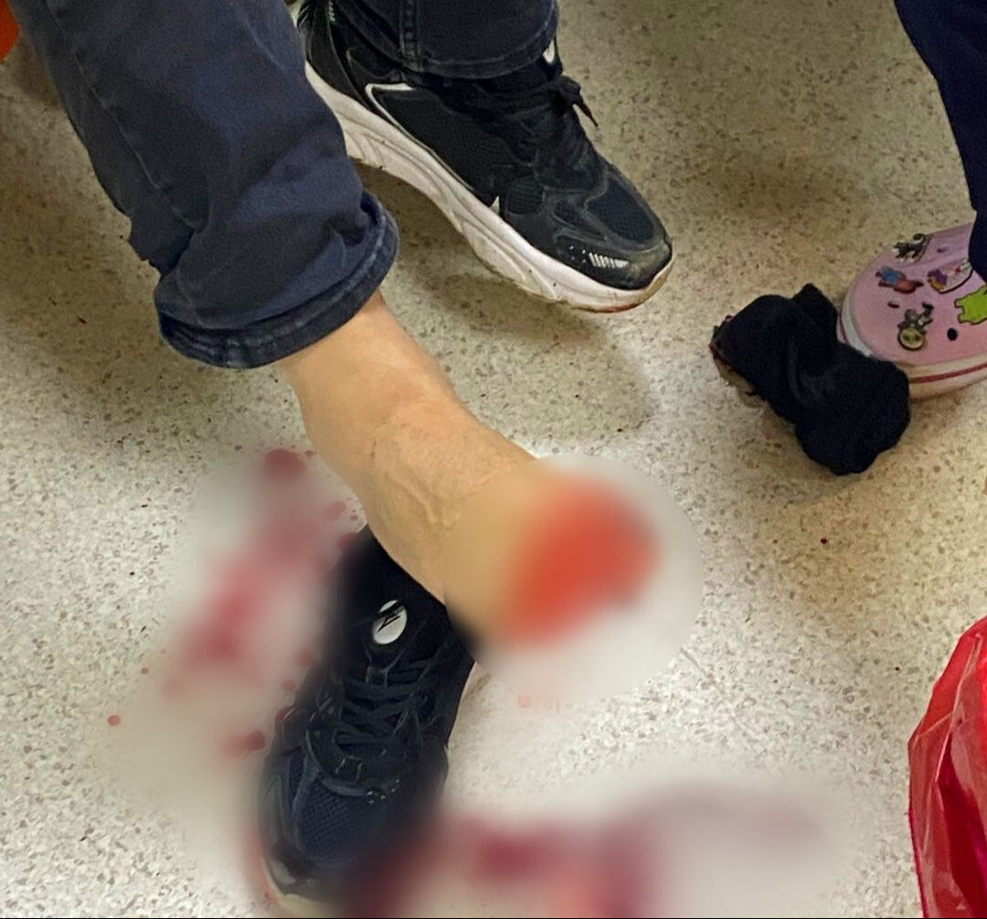 Samsun'da polise saldırı! Silahla ateş açtılar, yaralılar var Samsun'da polise saldırı! Silahla ateş açtılar, yaralılar var - 2. Resim