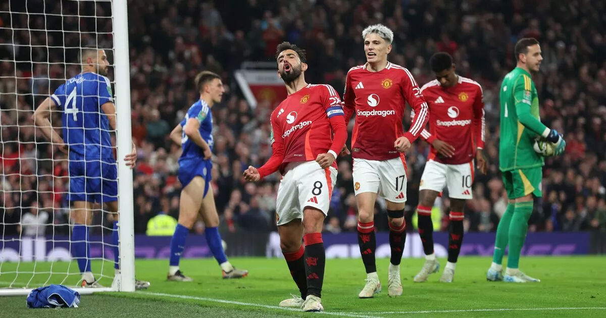 Şifresiz yayınlanacak! Manchester United - Leicester City maçı hangi kanalda, ne zaman, Altay Bayındır oynayacak mı? - 2. Resim