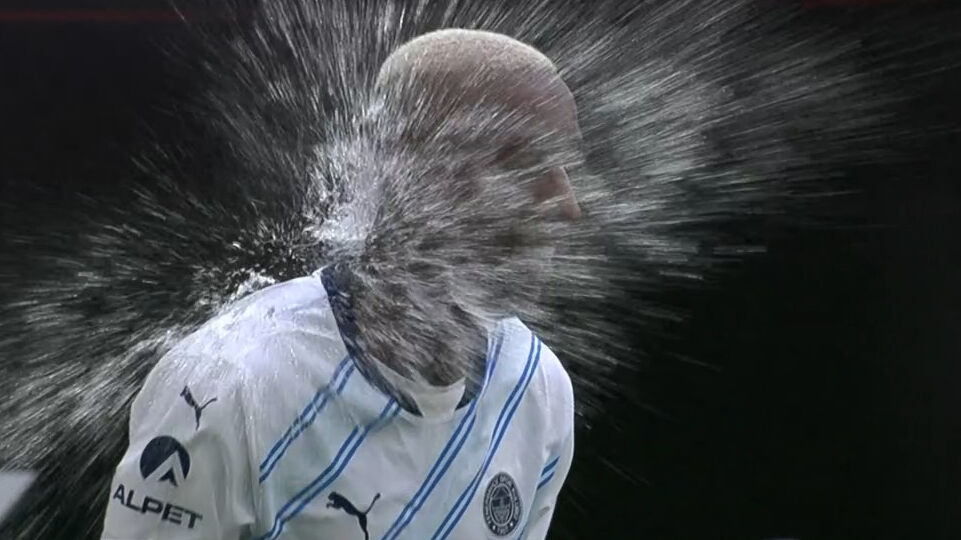 Fenerbahçe maçında akıl almaz olay! Anderson Talisca bir anda yerde kaldı Fenerbahçe maçında akıl almaz olay! Anderson Talisca bir anda yerde kaldı - 3. Resim