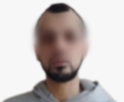 Camide saldırdığı çocuğu makasla yaraladı! Savunması da korkunç - 2. Resim