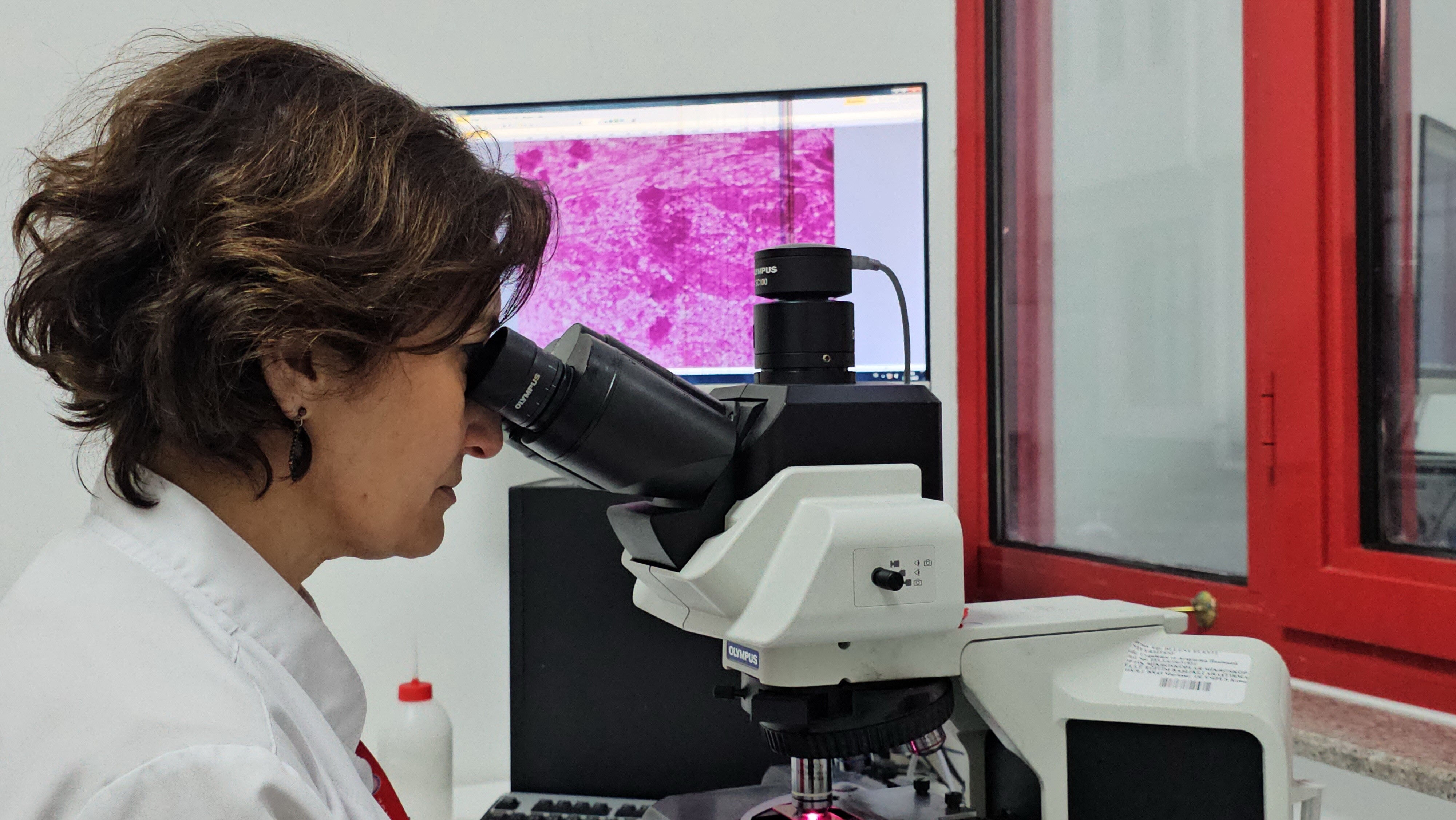 Tehlike zannettiğinizden büyük! Mikrobiyoloji uzmanı uyardı: Kist hidatik yavaş gelişir ama ölüme yol açabilir - 4. Resim