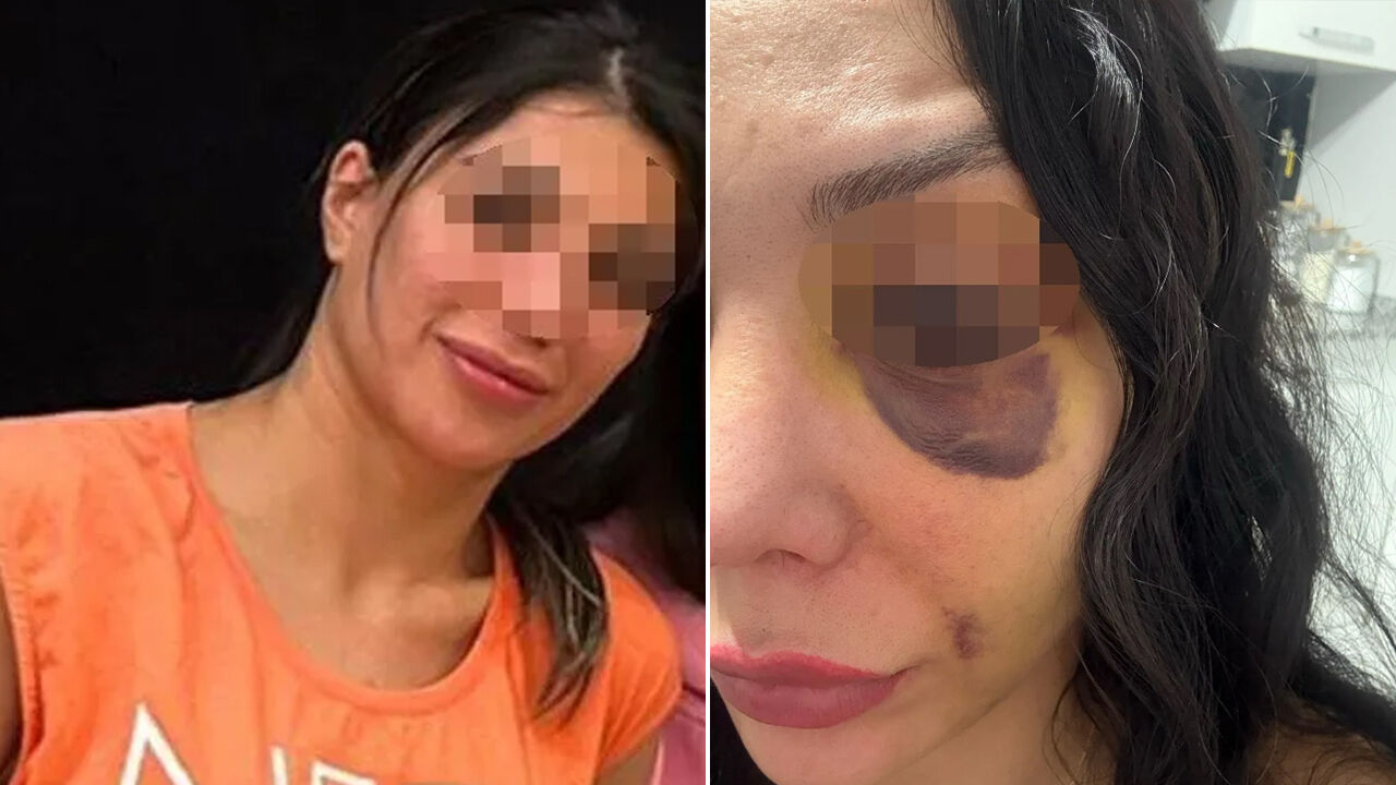 Eğlence merkezinde kıskançlık dehşeti! Tanınmaz hale getirdi Eğlence merkezinde kıskançlık dehşeti! Tanınmaz hale getirdi - 1. Resim