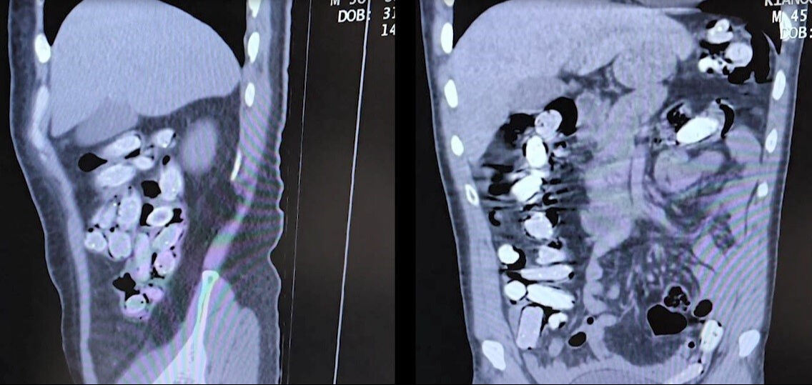 Zehir tacirlerinin bir yöntemi daha yok artık dedirtti! Uyuşturucuyu öyle bir yere saklamışlar ki... - 1. Resim