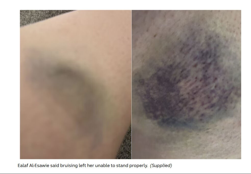 Hamile kadını kendi başörtüsüyle boğmaya çalıştılar! Avustralya Başbakanı Müslümanlardan özür diledi - 1. Resim