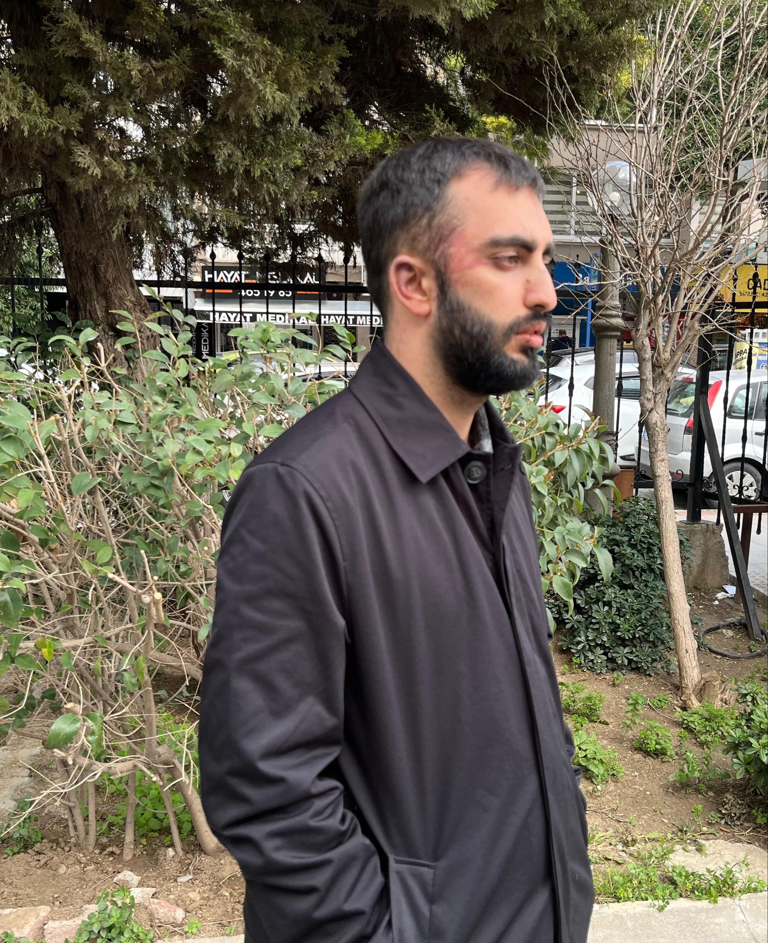 Önce başıboş köpekler ardından sahipleri saldırdı!  Çocuğuna bez almak istiyordu, 20 kişi birden darp etti Önce başıboş köpekler ardından sahipleri saldırdı!  Çocuğuna bez almak istiyordu, 20 kişi birden darp etti - 1. Resim