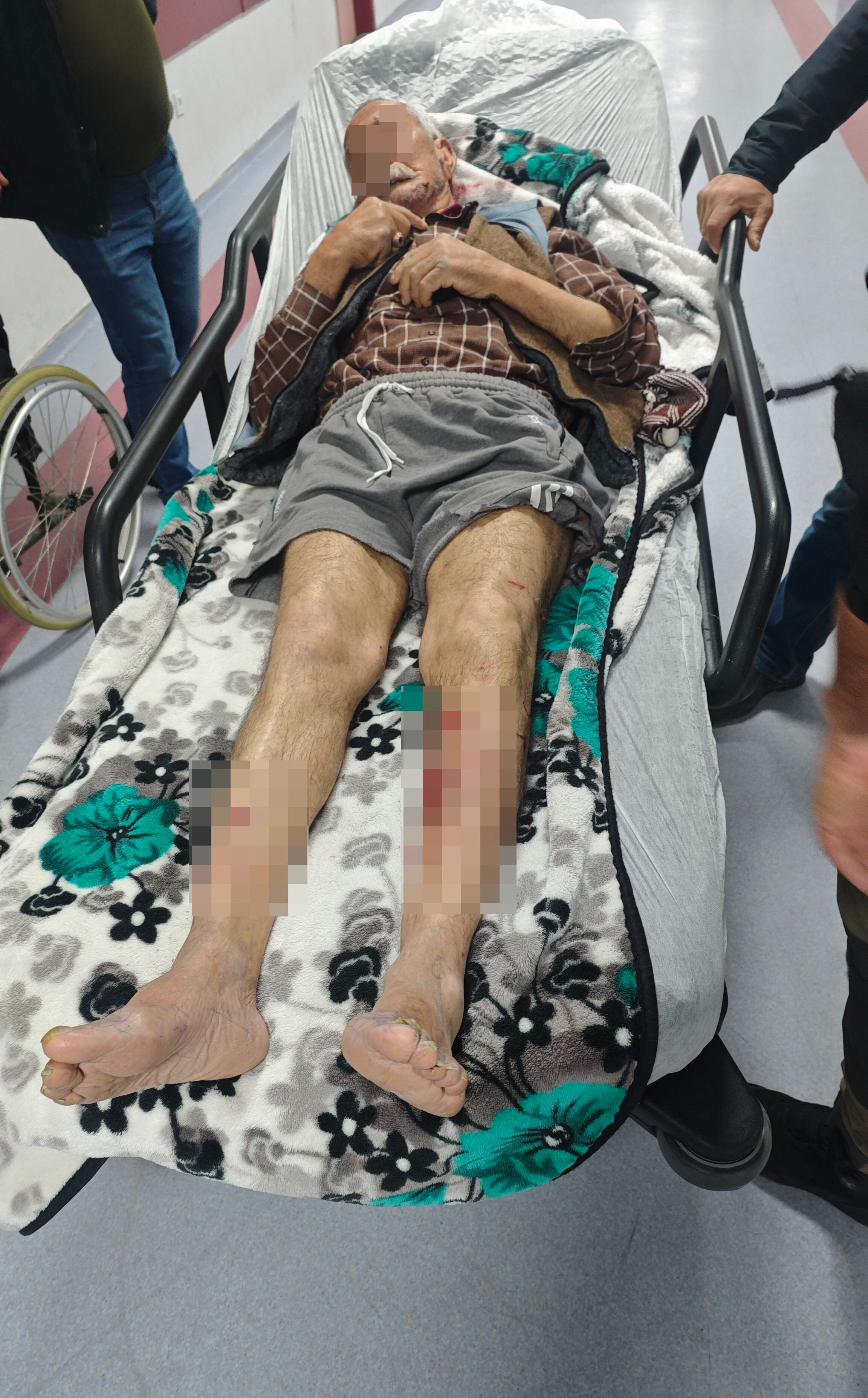 Alzheimer adam dehşeti yaşadı! Başıboş köpekler saldırdı, tam 25 yerinden ısırıldı - 2. Resim