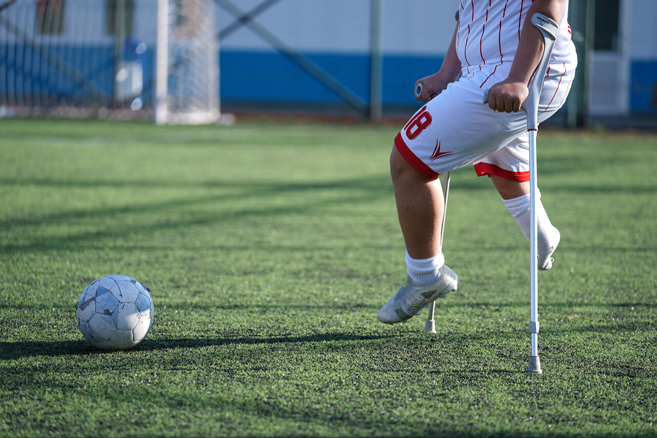Tek bacağıyla topa dans ettiriyor! Skolyoz hastalığı takıma girmesine engel olamadı Tek bacağıyla topa dans ettiriyor! Skolyoz hastalığı takıma girmesine engel olamadı - 1. Resim