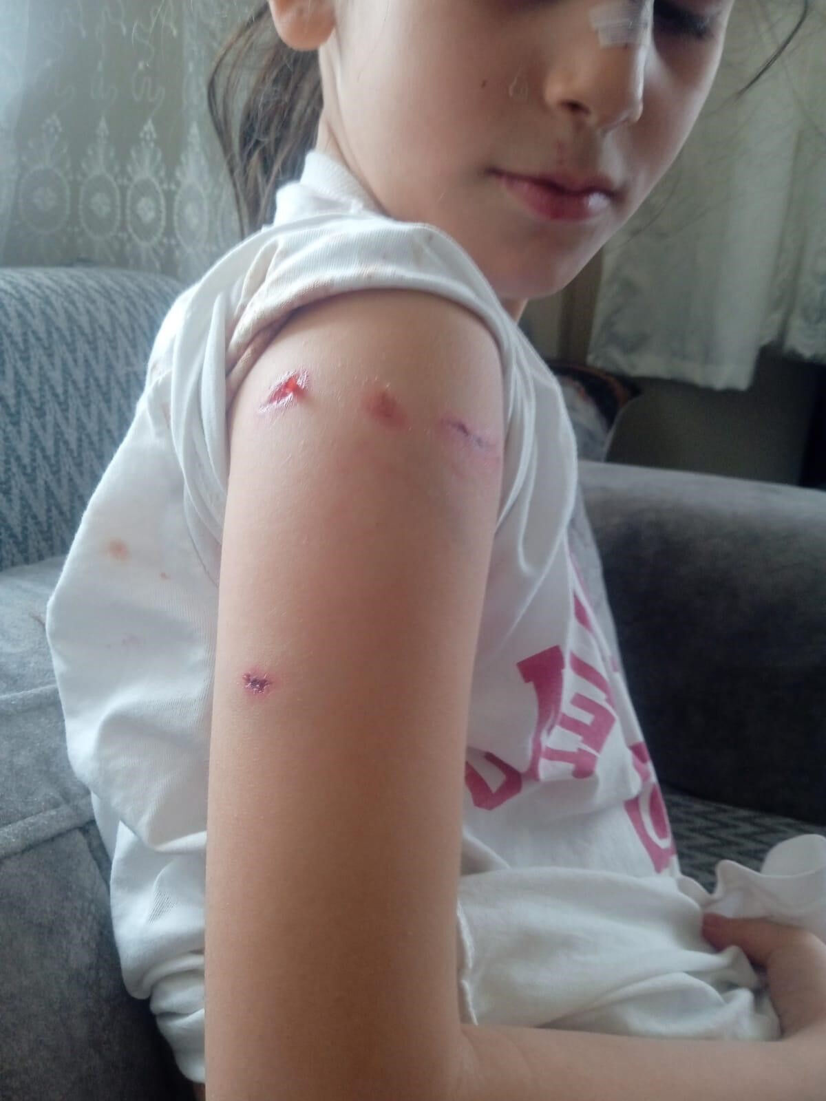 Dehşet anları! Okul bahçesine dalan köpek öğrencilere saldırdı - 3. Resim