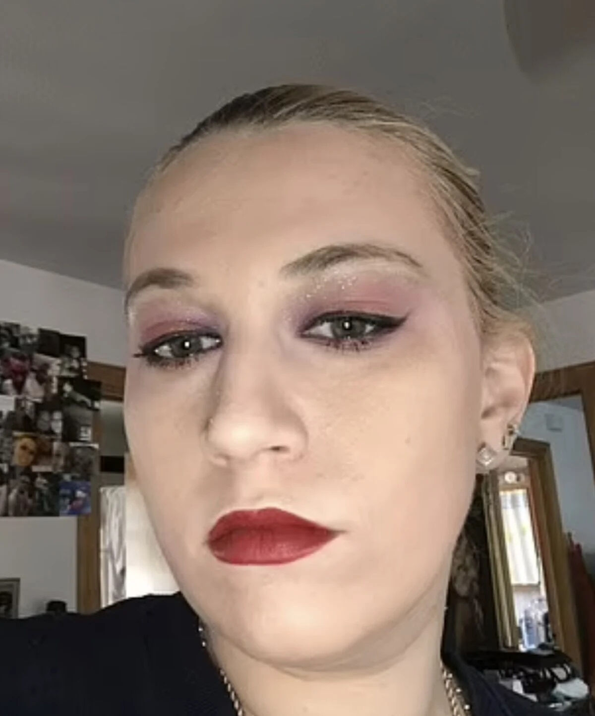 Uyuşturucu burnunu eritti! 15 operasyon geçirmek zorunda kaldı  - 3. Resim