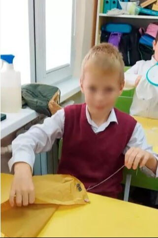 Kan donduran köpek saldırısı! Küçük çocuğun yüzü parçalandı, babası feryat etti Kan donduran köpek saldırısı! Küçük çocuğun yüzü parçalandı, babası feryat etti - 2. Resim