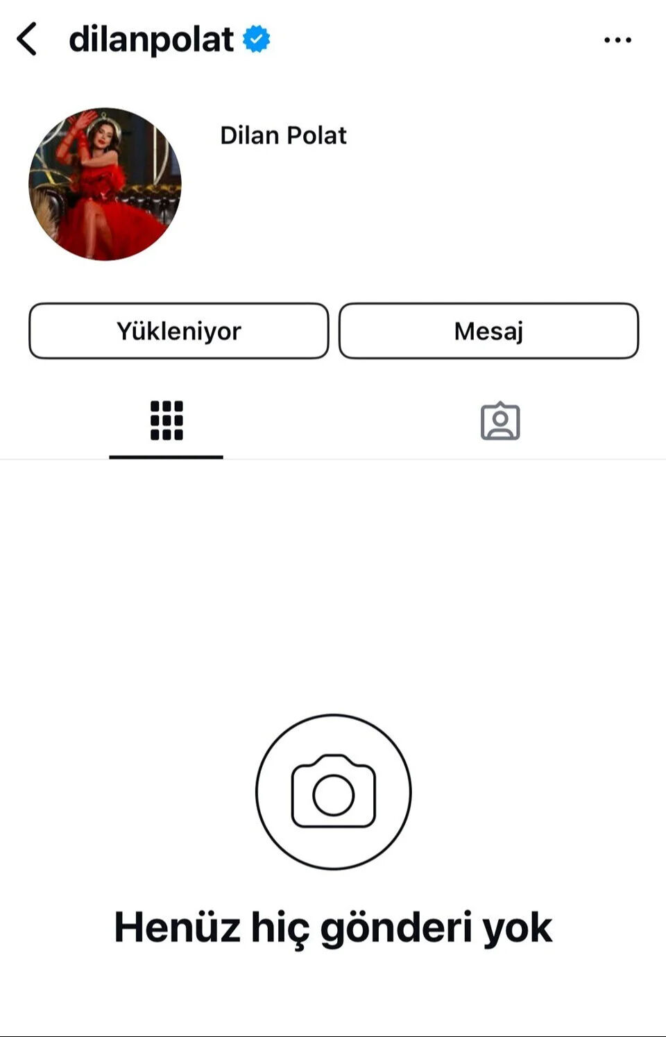 Dilan Polat'tan Instagram hamlesi! Sosyal medyada iddialar arka arkaya geldi Dilan Polat'tan Instagram hamlesi! Sosyal medyada iddialar arka arkaya geldi - 3. Resim