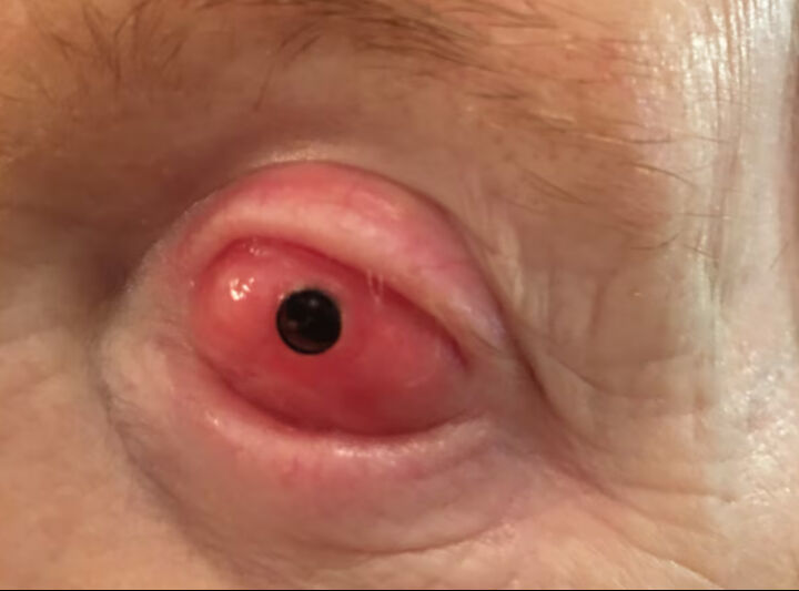 Görme engellilere umut ışığı! Dişten alınan parça göze takıldı Görme engellilere umut ışığı! Dişten alınan parça göze takıldı - 3. Resim