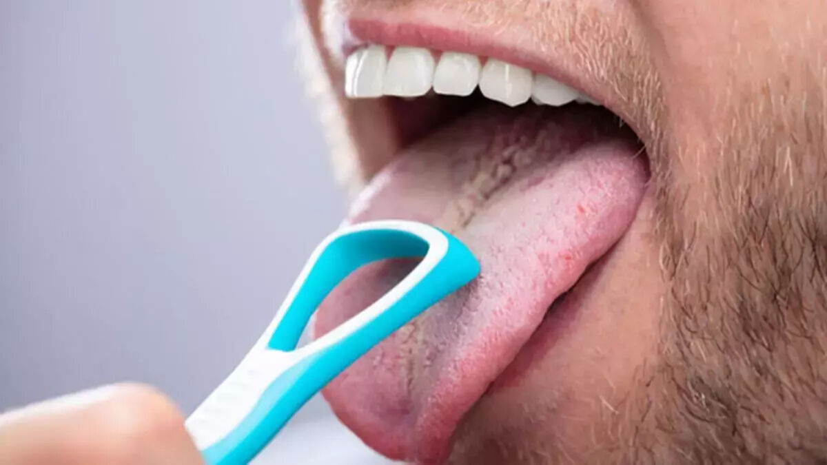 Ağız kokusu: Nedenleri, çözümleri ve unutulmaması gerekenler! - 3. Resim