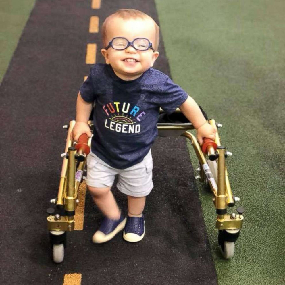 Dandy-Walker Sendromu: Belirtileri, nedenleri ve tedavisi - 4. Resim