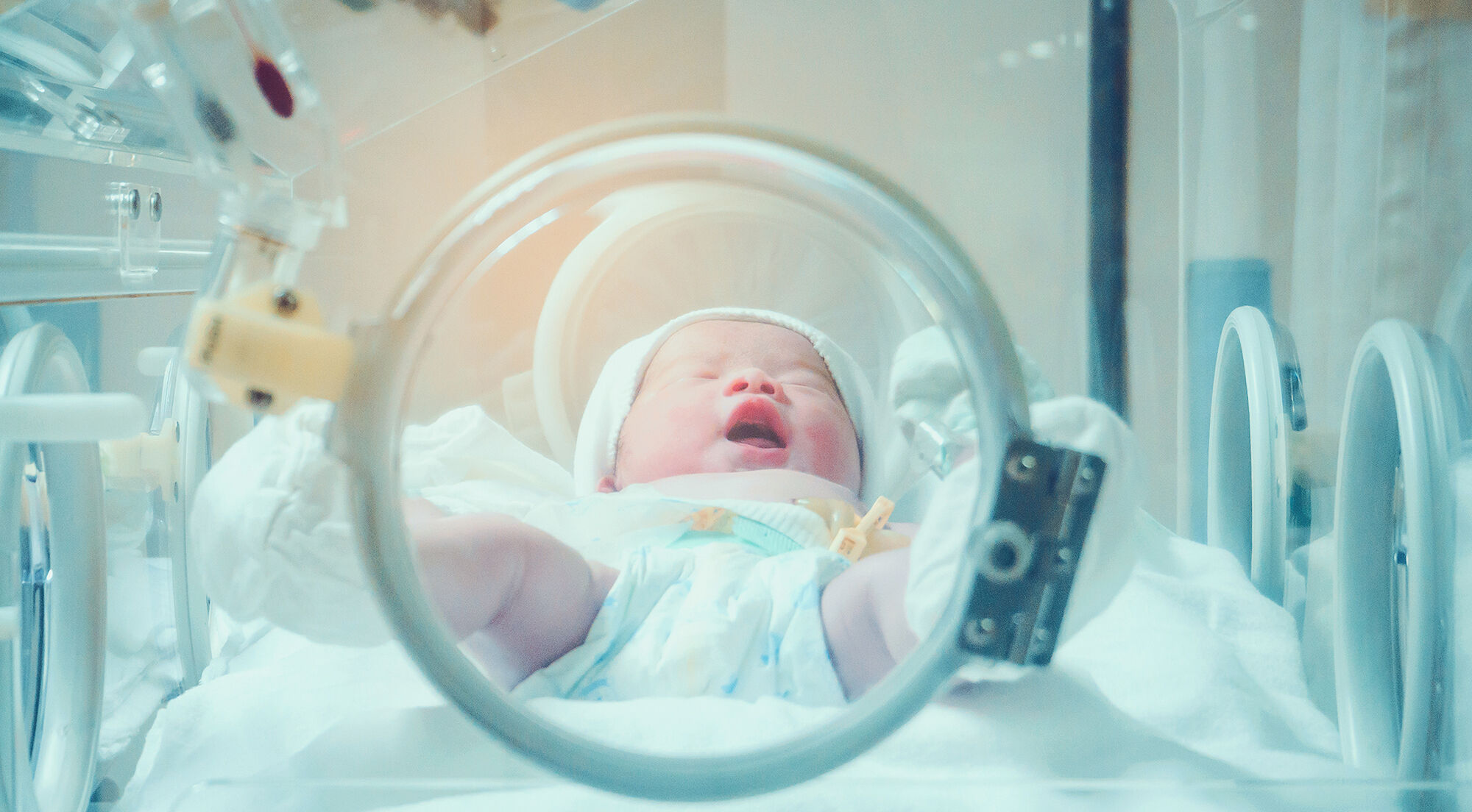 Minik ciğerlerin büyük savaşları: Yenidoğanlarda Respiratuvar Distres Sendromunu anlamak - 3. Resim