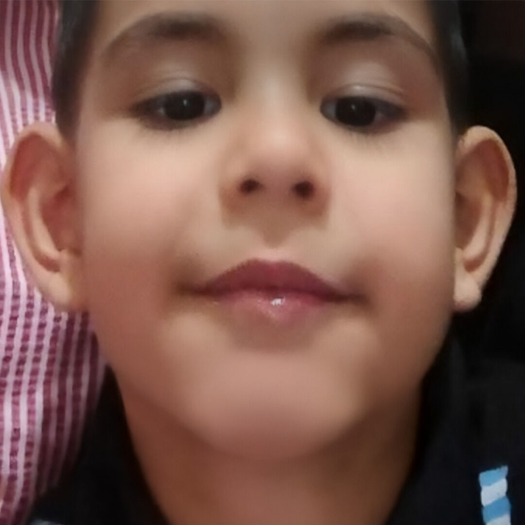 Motosikletin çarptığı minik Çınar hayatını kaybetti - 1. Resim