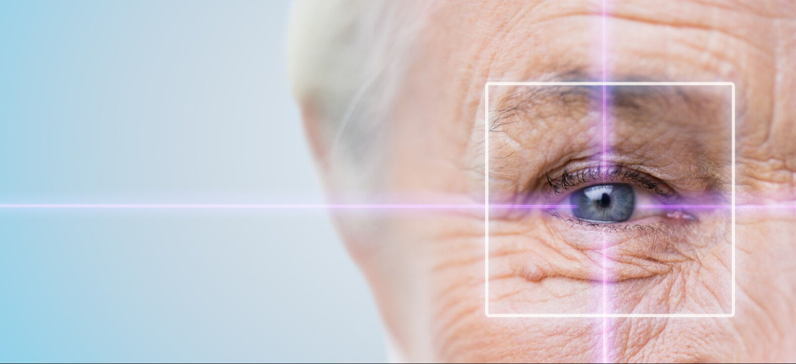 Glokom yenidoğanlarda da görülüyor... Göz bebekleri normalden büyükse dikkat! - 1. Resim